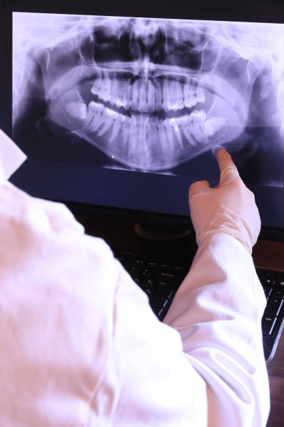 Best Same-Day Emergency Dental Services in Schler Park, IL